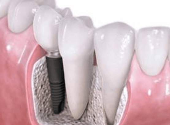 武汉治疗牙齿哪个医生技术不错？