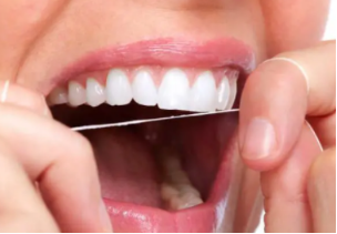 牙齿矫正拔4颗牙齿会有影响吗 整牙拔四颗牙会出现哪些后果